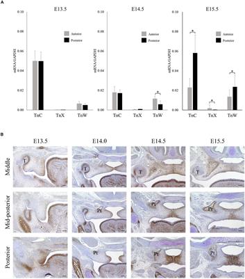 Transforming Growth Factor-Beta and Sonic Hedgehog Signaling in Palatal Epithelium Regulate Tenascin-C Expression in Palatal Mesenchyme During Soft Palate Development